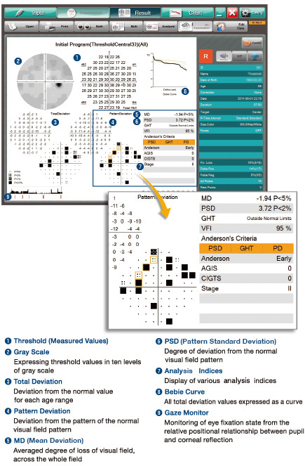 Clear Display of Analysis Results