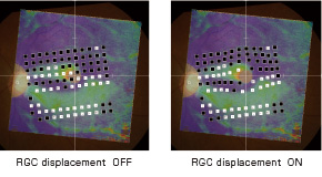 RGC displacement