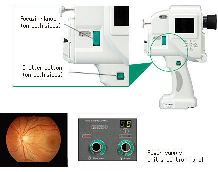 GENESIS-D (for color retinal photography)