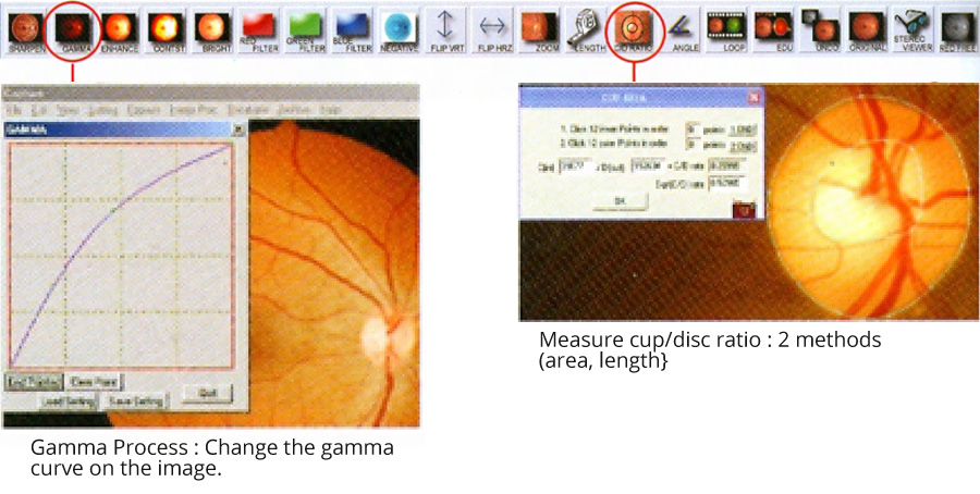 Image processing according to diagnostic needs